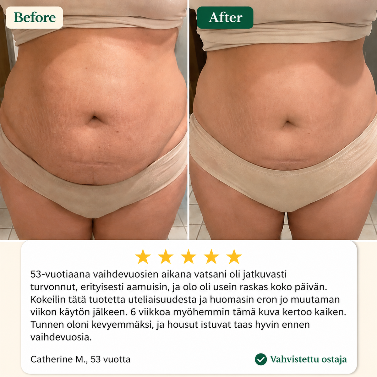 Dolyne™ LymphaDrain