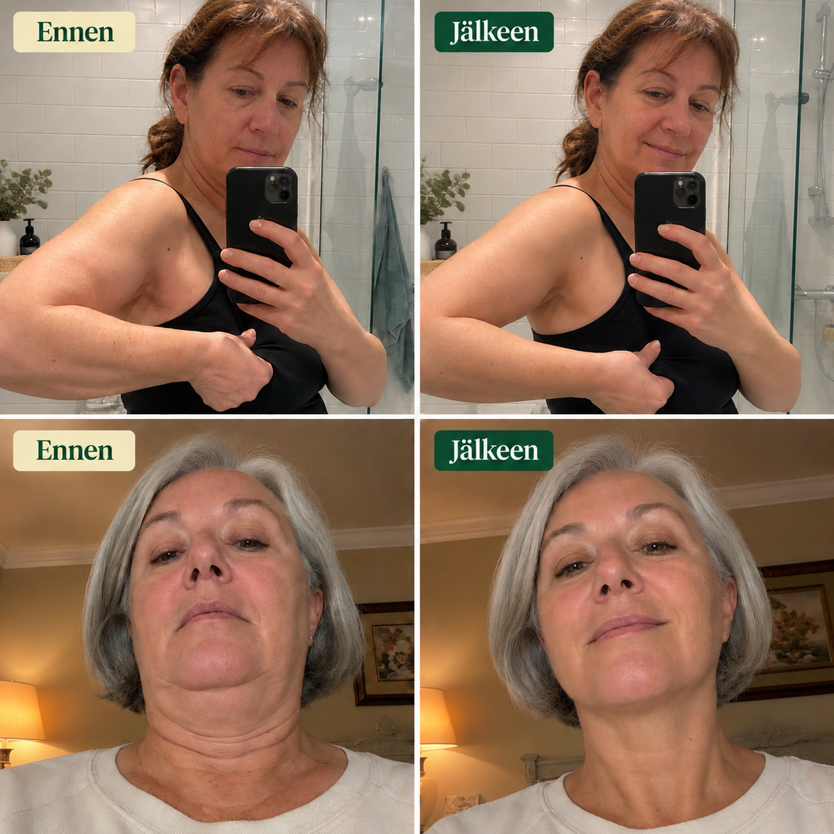 Dolyne™ LymphaDrain