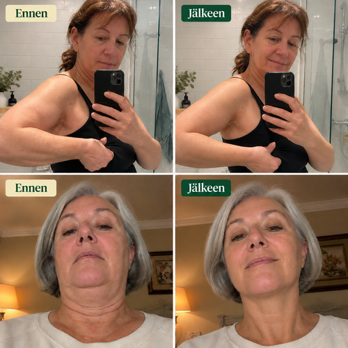 Dolyne™ LymphaDrain